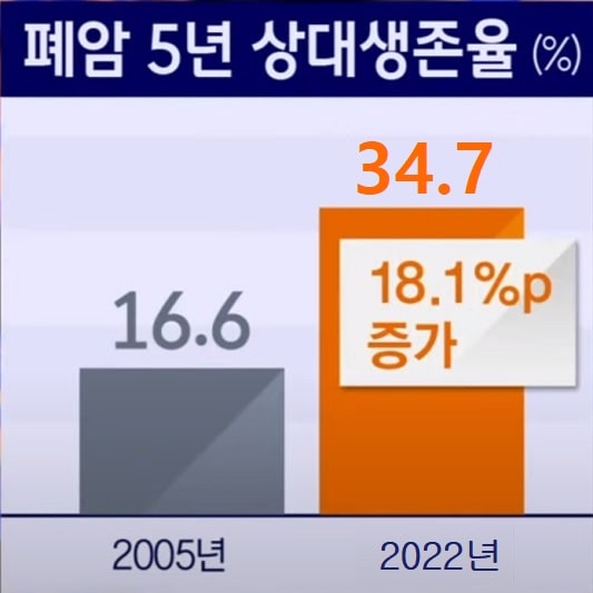 폐암 증상