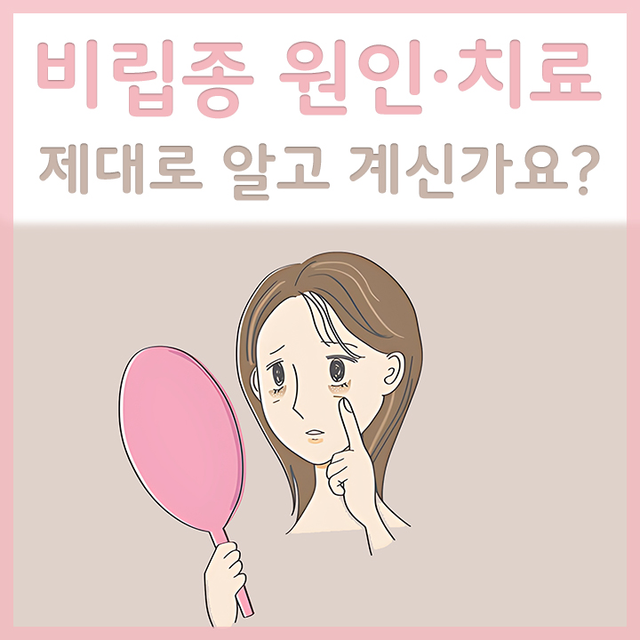비립종으로-걱정인-여성