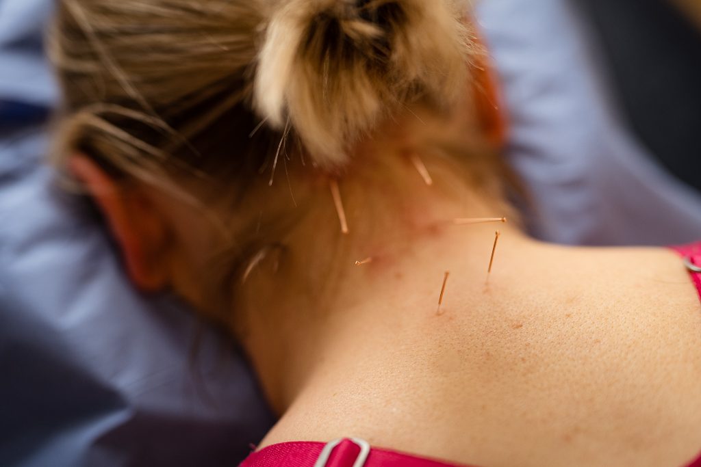 경추 추간판 탈출증 목디스크 침술 및 치료적인 운동