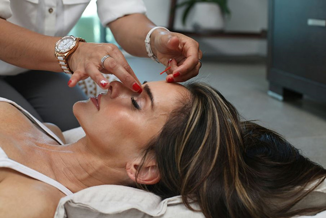 한의원에서 얼굴에 침을 맞는 여성 사진