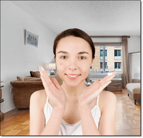 피부염 치료 여성