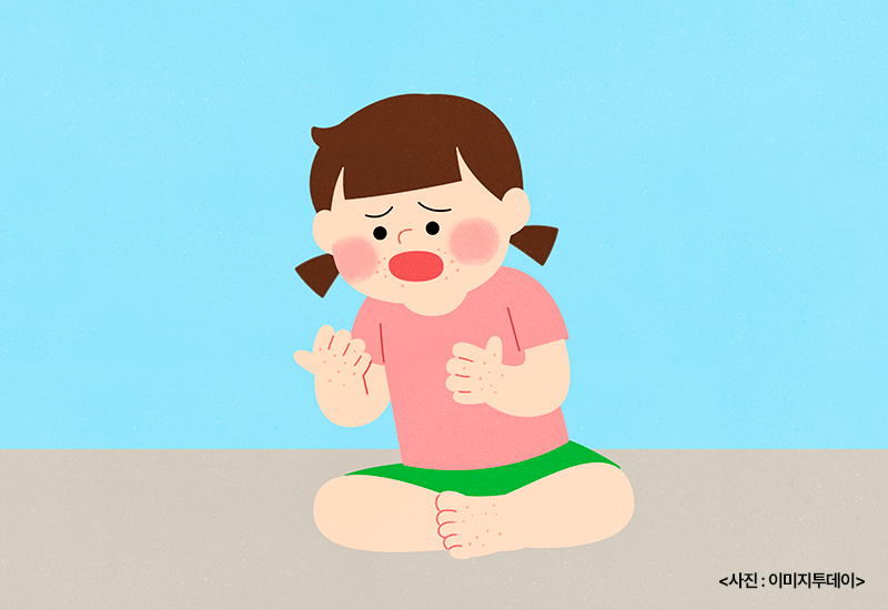 수족구병