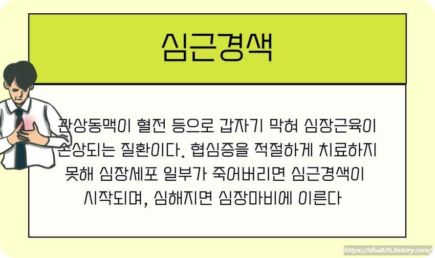 심근경색