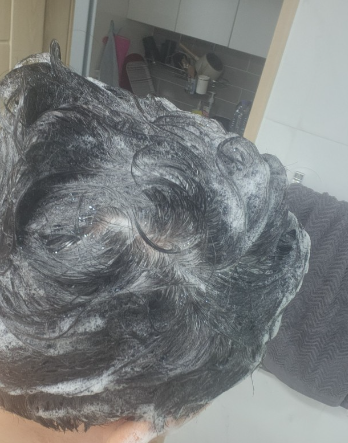 탈모약_1위_닥터메리디안