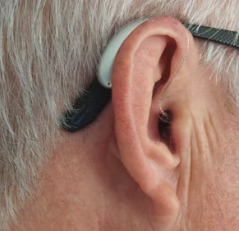 이석증 증상 후유증 원인 예방치료방법