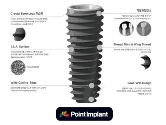 오스템 임플란트 수명 시술기간_21