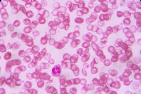 백혈구 정상수치