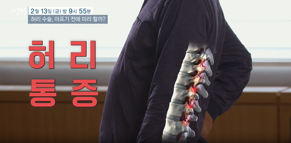명의- 허리 수술, 아프기 전에 미리 할까?