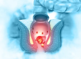 치질 자가치료법