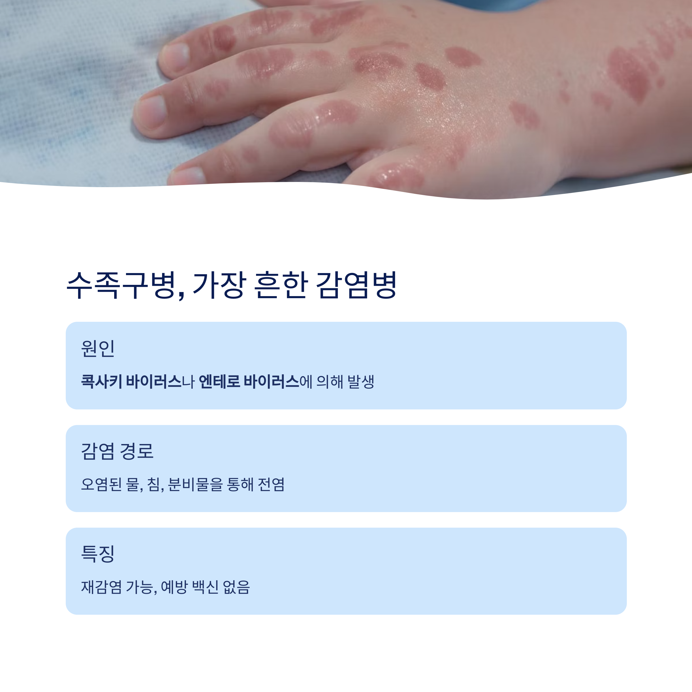 수족구병 가장 흔함 감염병