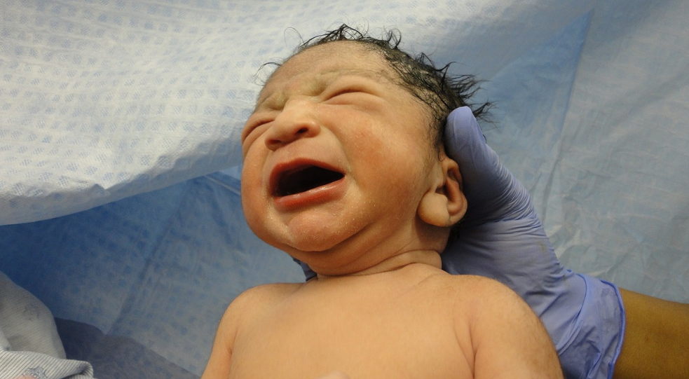 분만 관련 사진