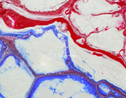 편두통 원인 증상 없애주는 간단한 습관 5가지