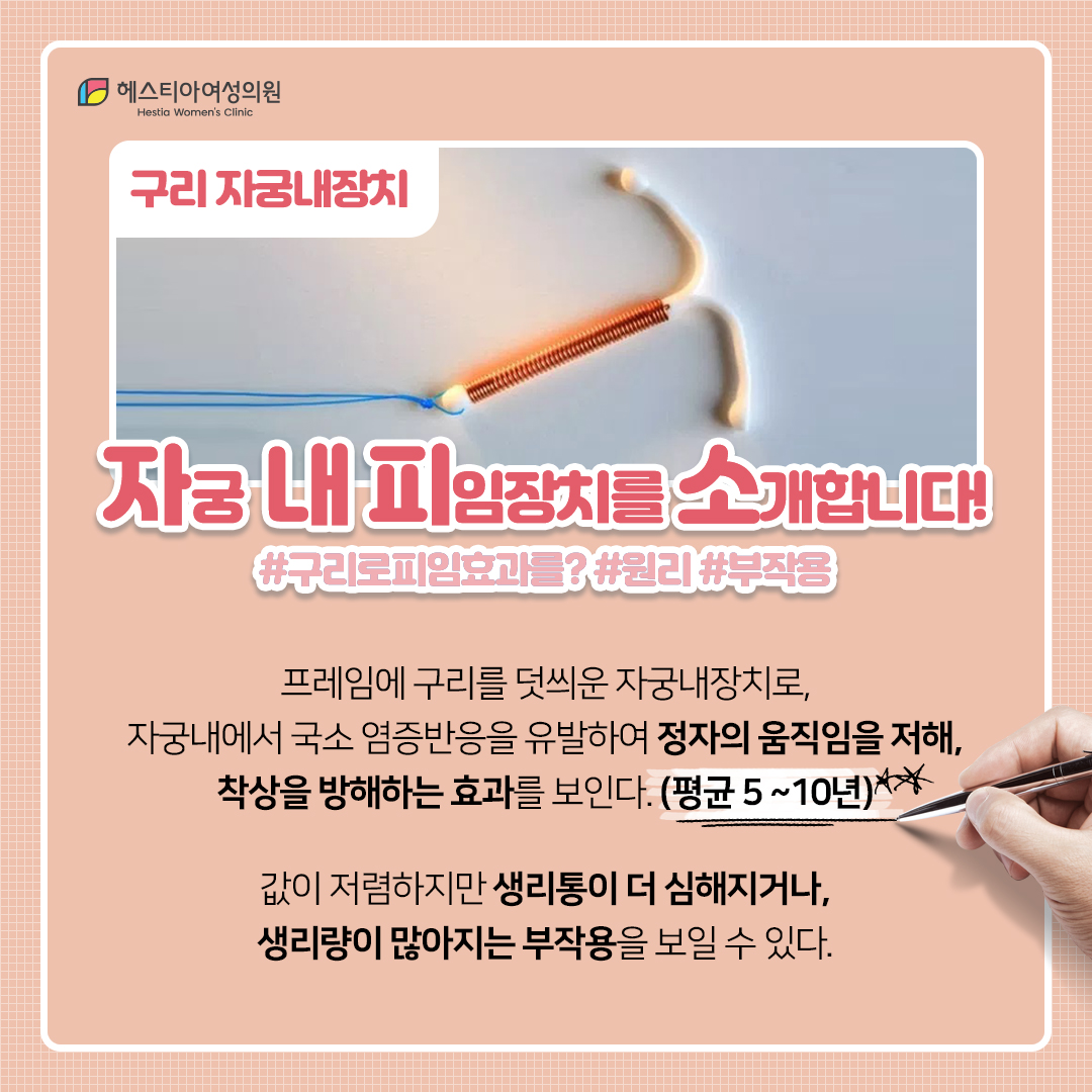 구리자궁내장치