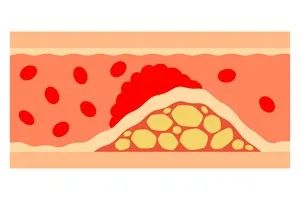 콜레스테롤-정상수치