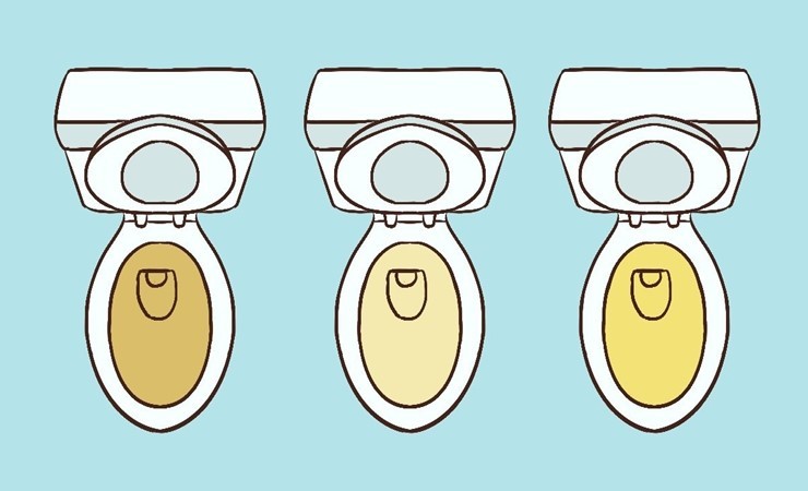 오줌 색깔과 병