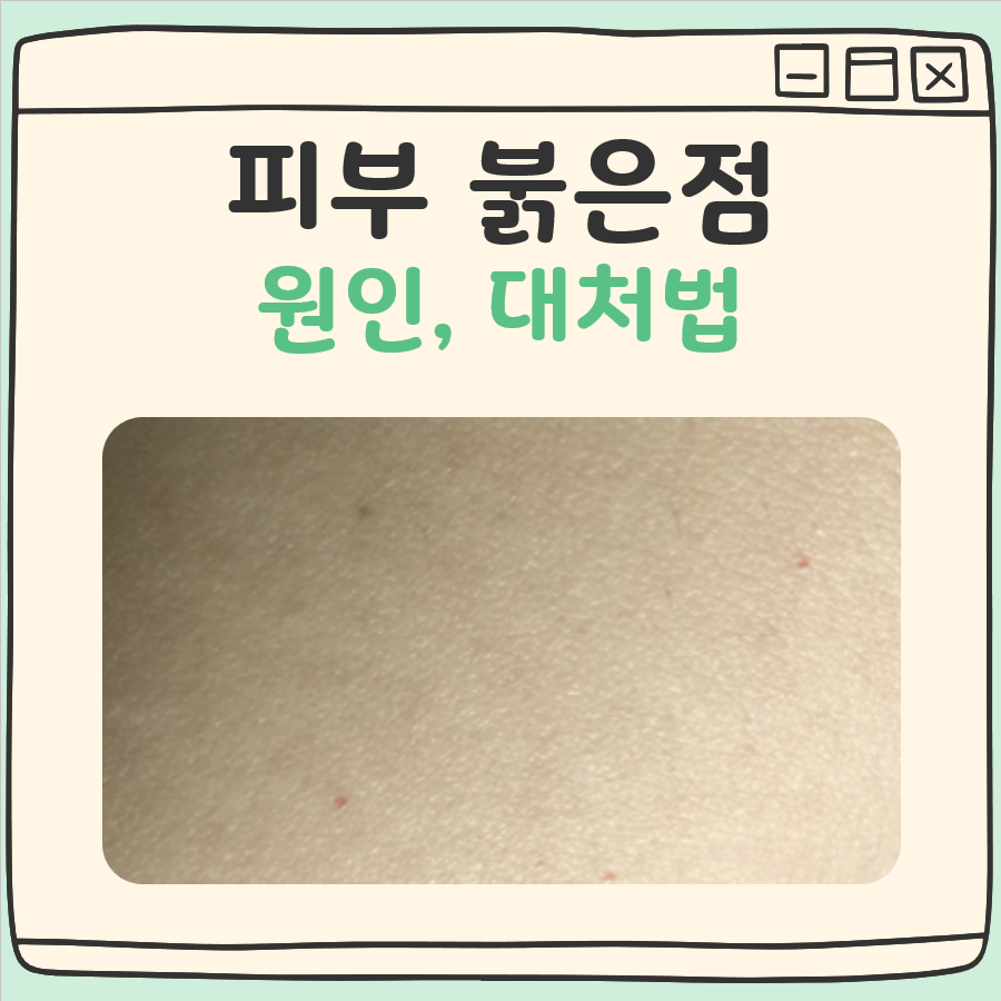 피부 붉은점 대표 이미지