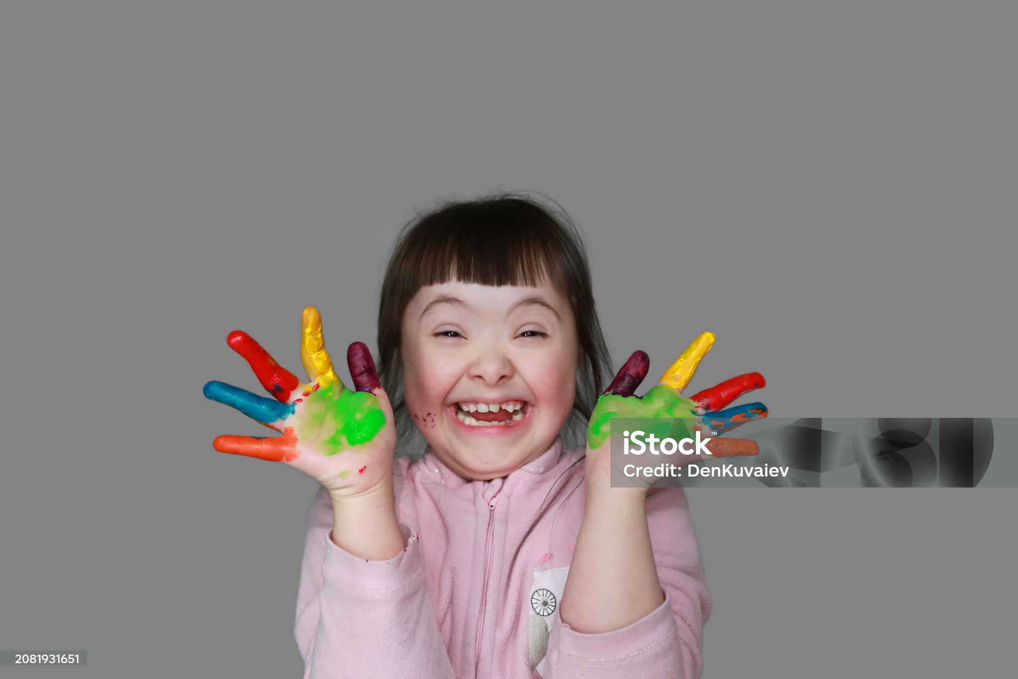 다운증후군-관련-사진