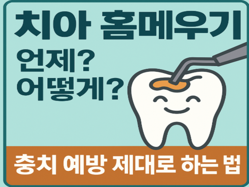 치아 홈메우기