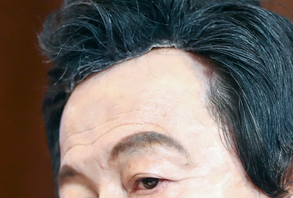 한동훈 대머리