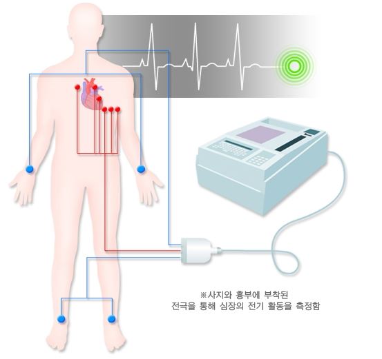 심전도-검사
