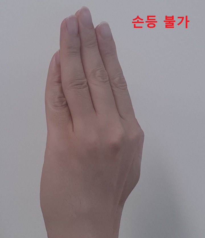 손등모양 보임