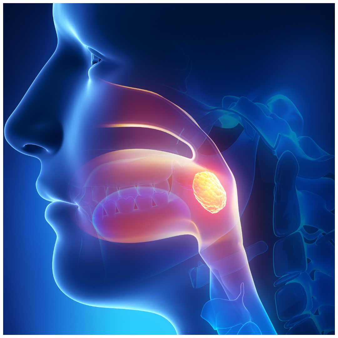 왼쪽 목 통증 원인 침삼킬때 왜 더심할까? 아플때 대처 방법