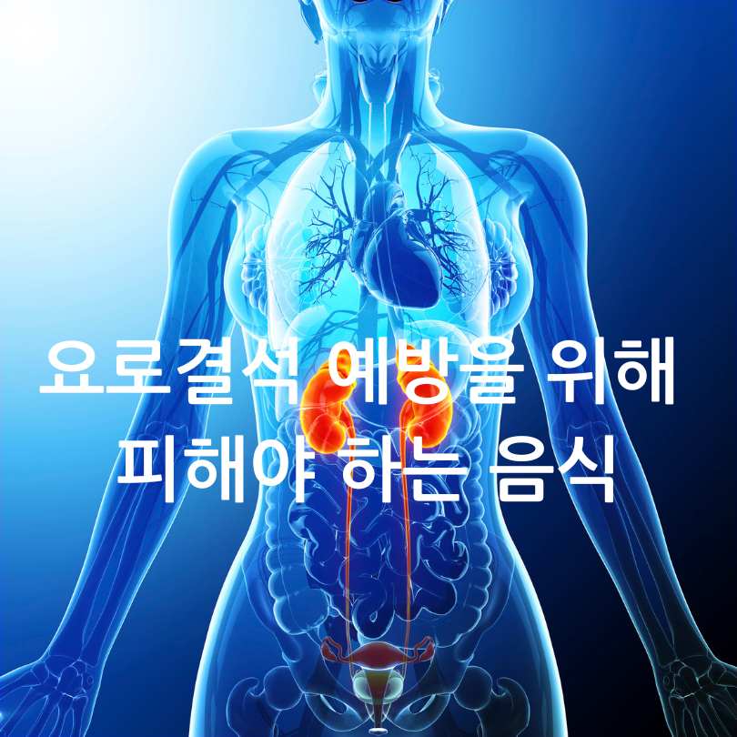 요로결석 증상과 피해야 하는 음식