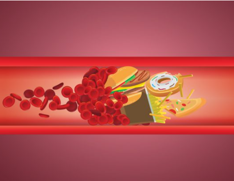 콜레스테롤 낮추는 방법