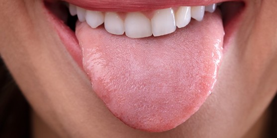 당뇨 초기 증상