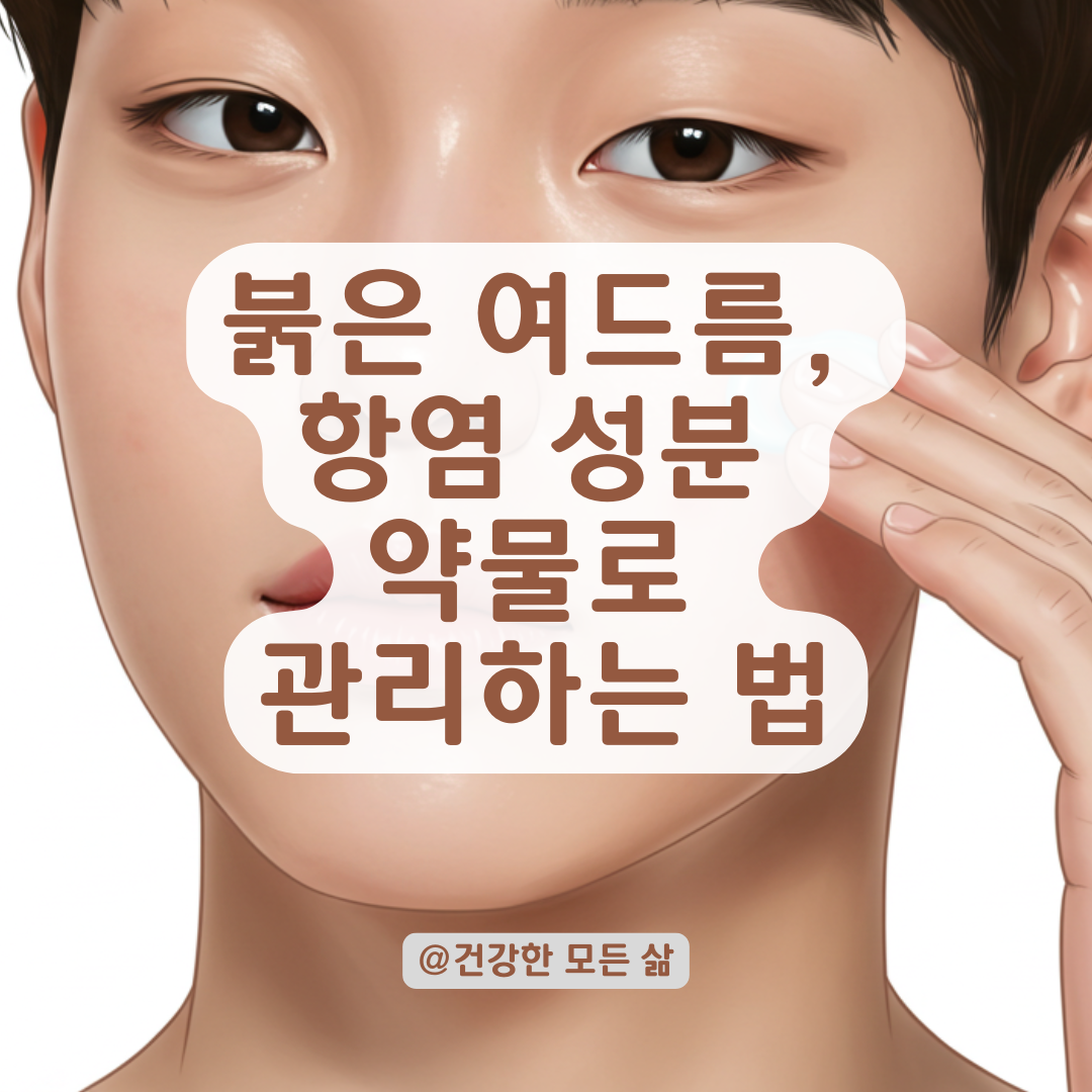 붉은 여드름이 자주 난다면? 항염 성분 약물로 완화하는 방법 총정리.