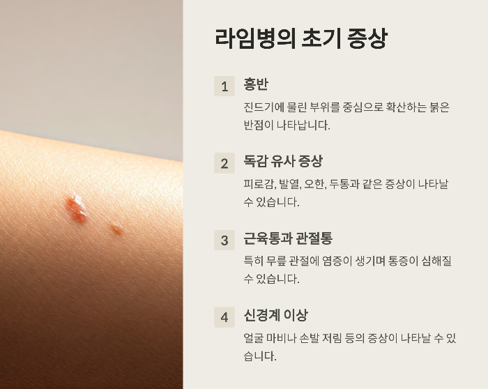 라임병 초기 증상