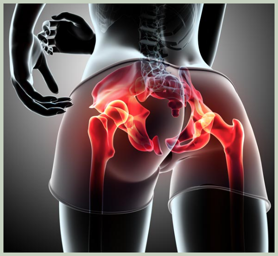 골반뼈 통증 예방법