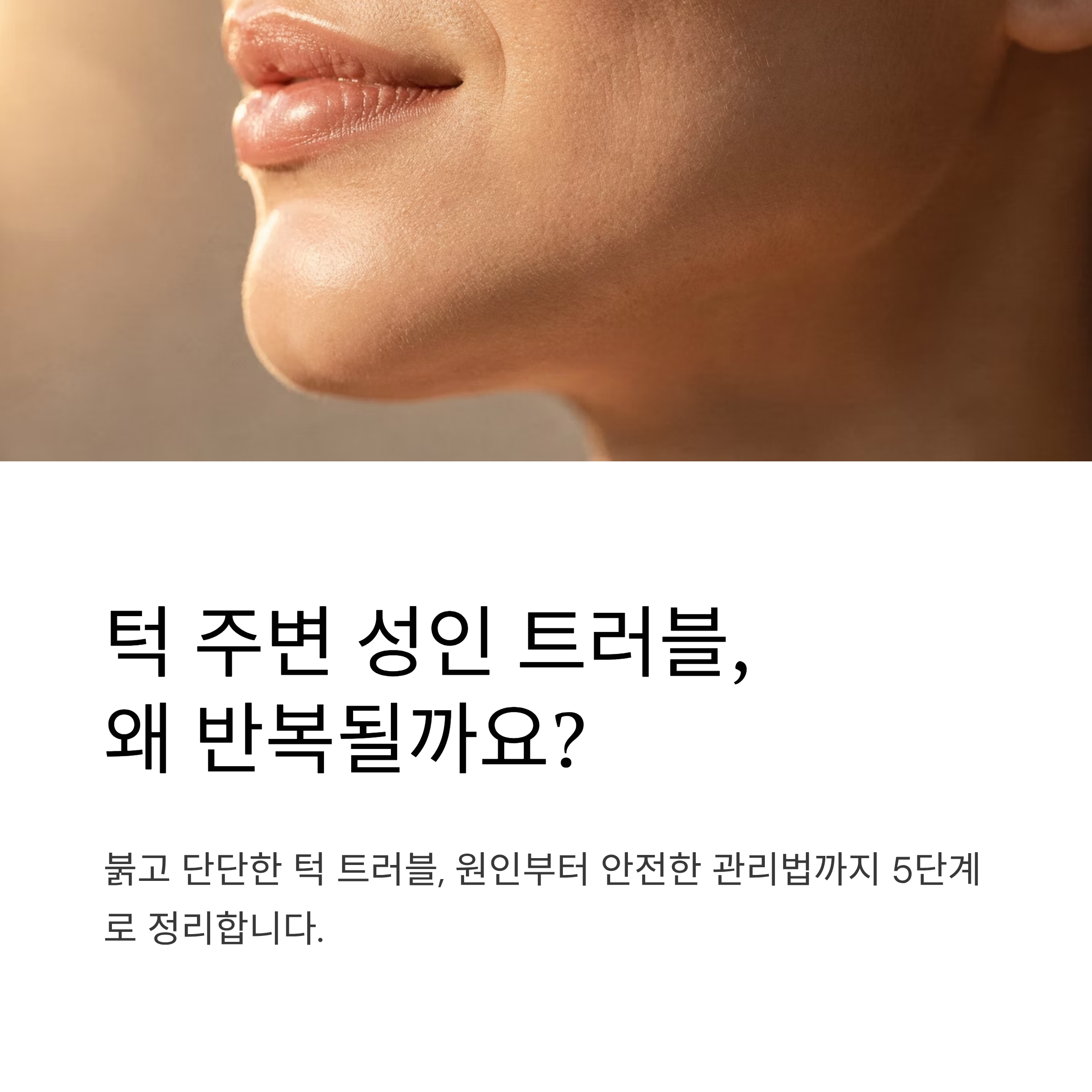 턱 주변 성인 트러블
