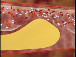 총콜레스테롤 정상수치