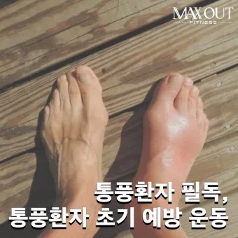 발가락 통풍 증상 및 대처방법_4