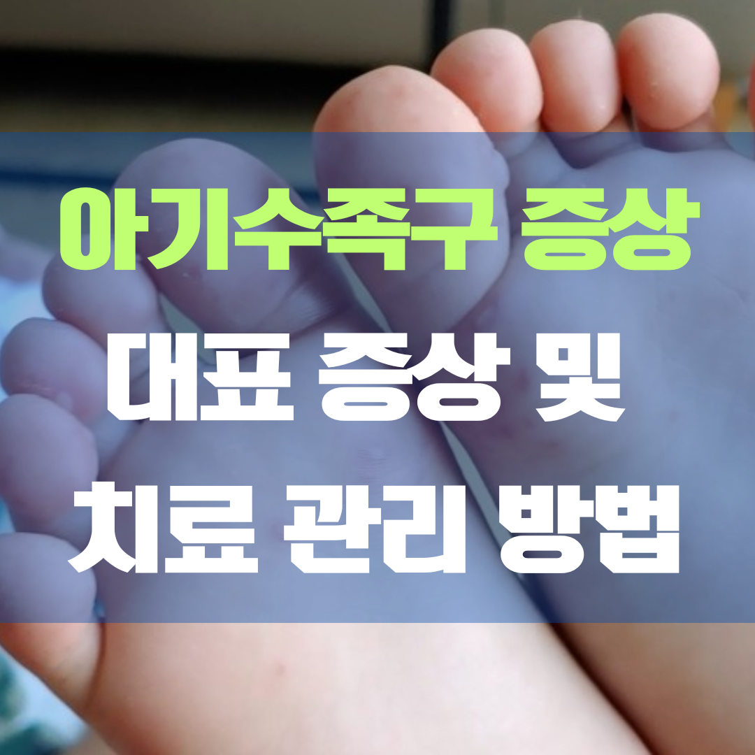 아기 수족구 대표적인 증상, 이럴 땐 이렇게 관리하세요