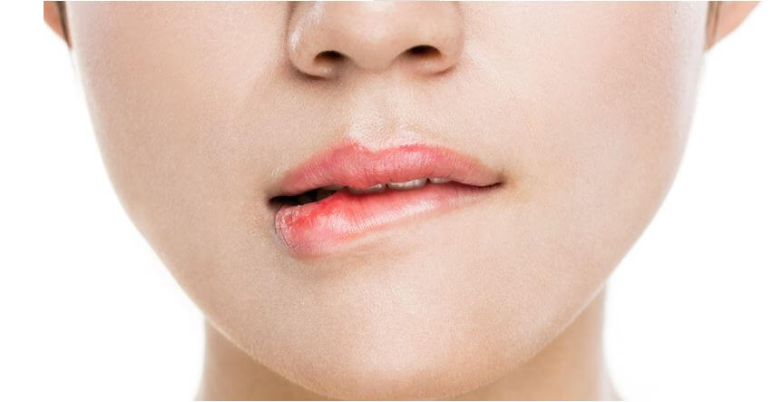 구내염으로 인한 통증