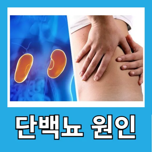 단백뇨 원인