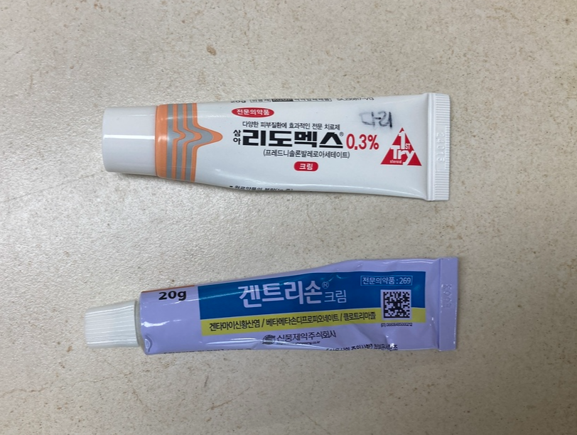 아토피 의료용 스테로이드 연고