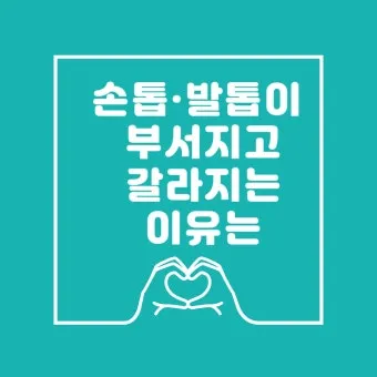 손톱이 갈라지는 이유 원인 증상 대처법_21