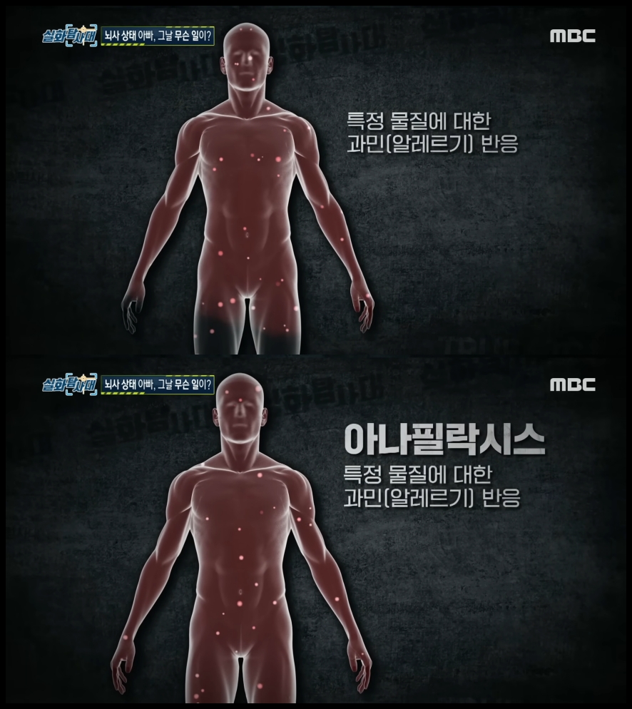 실화탐사대 여수 정형외과