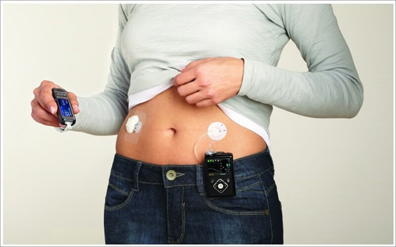 췌장에 좋은 음식