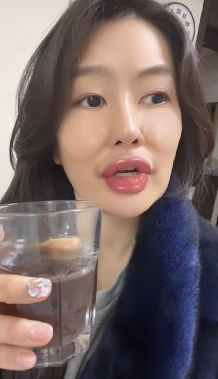 이수민 입술 얼굴