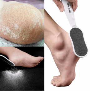 발각질제거기 수동 전동 타입 비교