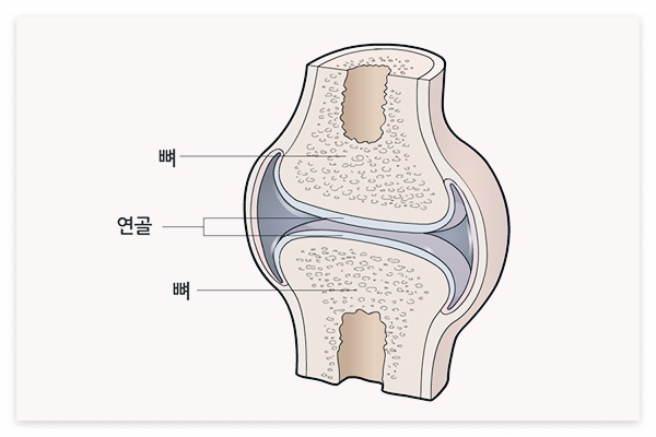 콘드로이친 효능