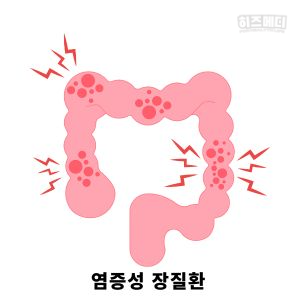 배에 가스가 자주 차는 이유