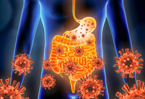 노로바이러스 증상