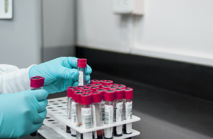 화학 반응의 기본 원리 쉽게 설명하기