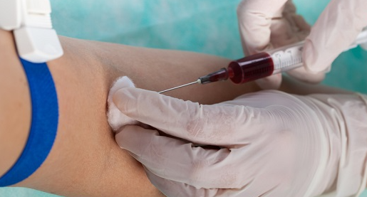 주사기로-팔에서-피를뽑는-남성