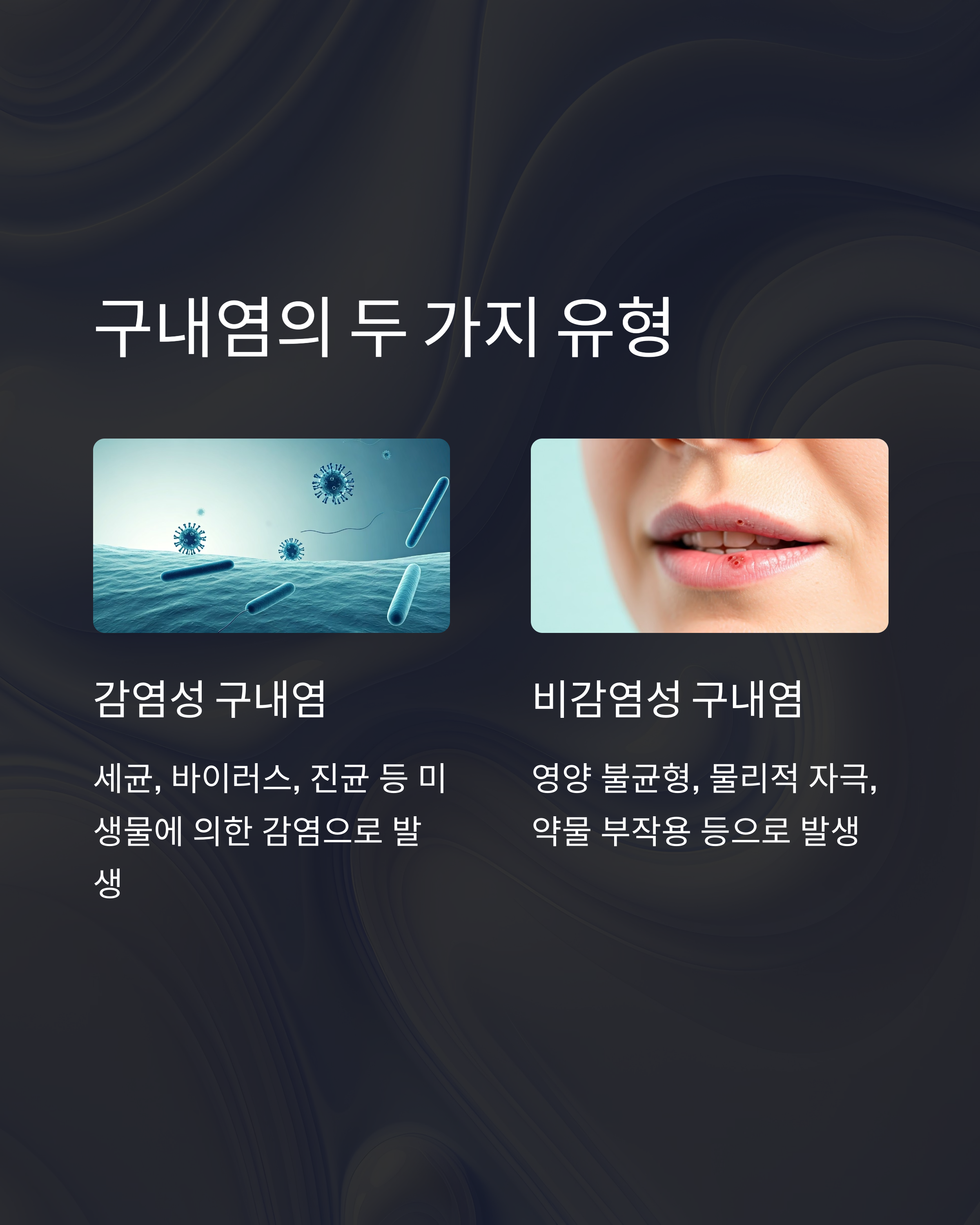 구내염 두가지 유형